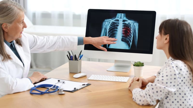 Rakovina plic čím dál častěji postihuje i nekuřáky. Pozor by si měly dávat zvláště ženy